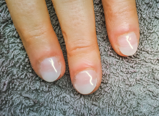 Nailbiter after gel nails