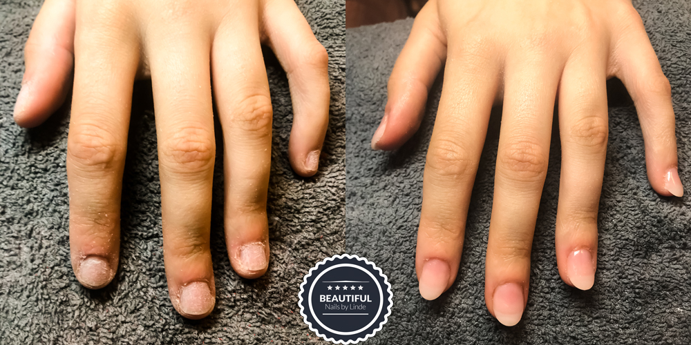 Before and after makeover using CND liquid & powder topped with CND shellac  to help strengthen those brittle nails! – Mel's Nail Co