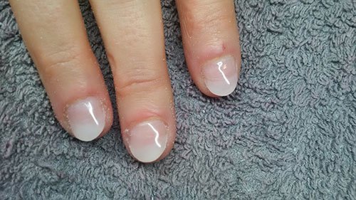 Nagelbijter resultaat Beautiful Nails by Linde Leuven